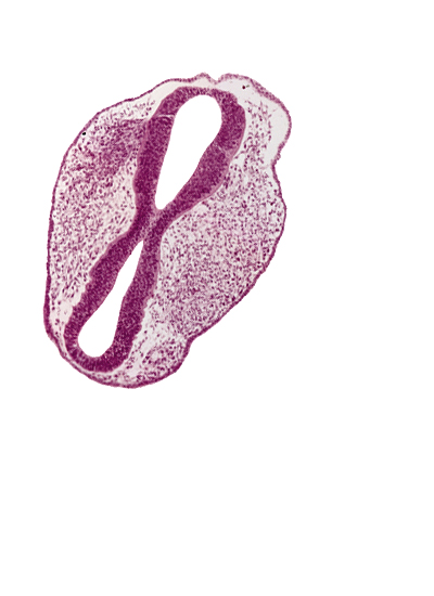 diencephalon (D2), head mesenchyme, mesencephalon (M1), mesencephalon (M2), mesencoel, prosencoel (third ventricle), rhombencephalon (Rh. 2), rhombencoel (fourth ventricle), roof plate, surface ectoderm, trigeminal neural crest (CN V)