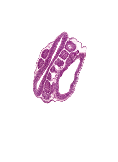 intermediate mesenchyme, lumen of neural tube, mesonephric duct, neural tube wall, peritoneal cavity, somite 18 (T-6), somitocoel