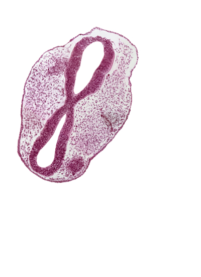 diencephalon (D2), edge of optic vesicle, floor plate of mesencephalon (M2), head mesenchyme, mesencephalon (M1), mesencoel, prosencoel (third ventricle), rhombencephalon (Rh. 2), rhombencephalon (Rh. 3), rhombencoel (fourth ventricle), roof plate, surface ectoderm, trigeminal neural crest (CN V)