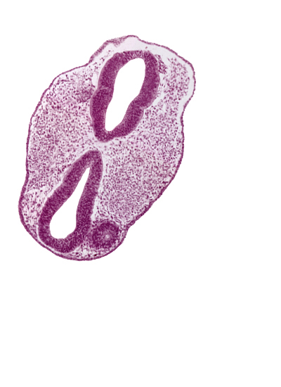 diencephalon (D1), diencephalon (D2), edge of intraretinal space (optic vesicle cavity), facio-vestibulocochlear neural crest (CN VII and CN VIII), mesencephalon (M1), mesencoel, optic neural crest (D1), optic vesicle (D1), prosencoel (third ventricle), region of mesencephalic (cephalic) flexure, rhombencephalon (Rh. 2), rhombencephalon (Rh. 3), rhombencephalon (Rh. 4), rhombencoel (fourth ventricle), surface ectoderm, vascular plexus