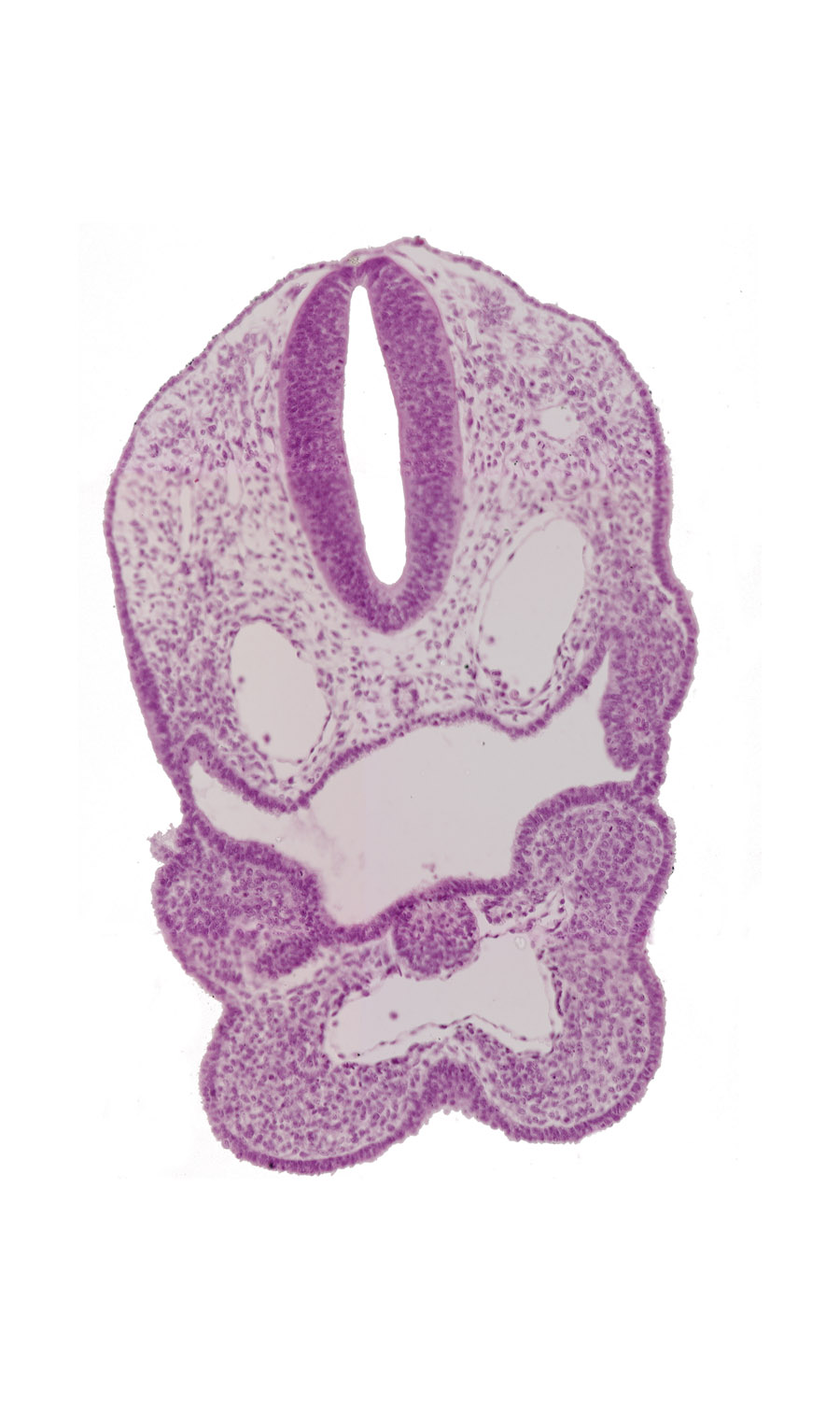 aortic sac, caudal edge of median mandibular groove, dermatomyotome 1 (O-1), dorsal aorta, ectodermal ring, origin of aortic arch 2, pharyngeal arch 3, pharyngeal groove 1, pharyngeal groove 2, pharyngeal membrane, pharyngeal pouch 2, pharyngeal pouch 3, precardinal vein, rhombencephalon (Rh. D), rhombencoel (fourth ventricle), thyroid diverticulum