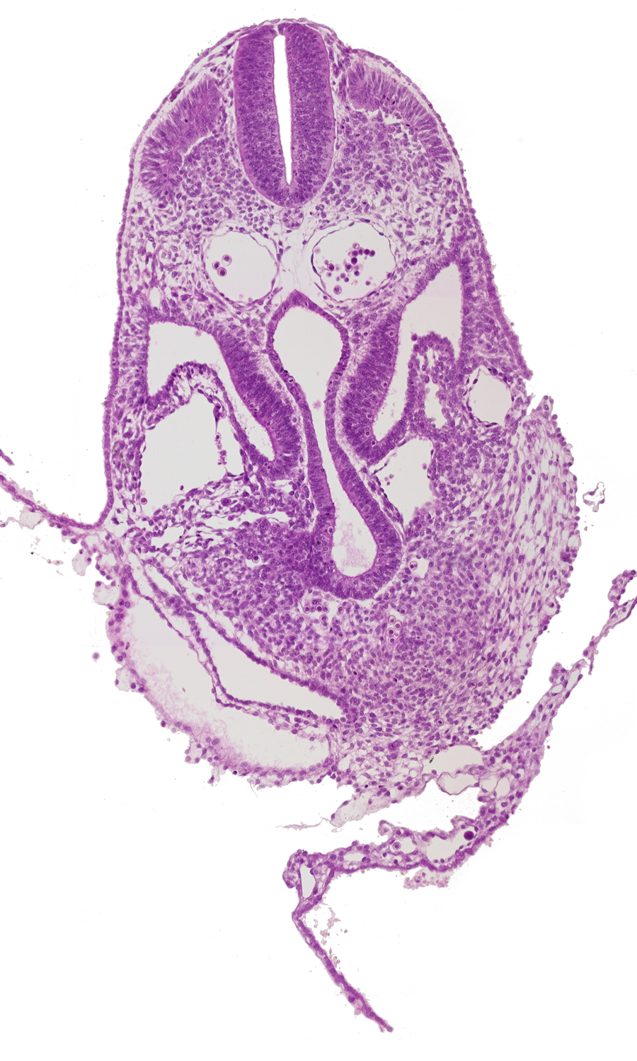 amnion, amnion attachment to ventral body wall, amniotic cavity, caudal part of pericardial cavity, dermatomyotome 6 (C-2), hemopoietic tissue, hepatic venous plexus, left umbilical vein, left vitelline (omphalomesenteric) vein, midgut, postcardinal vein, right horn of sinus venosus, sclerotome, umbilical vesicle wall