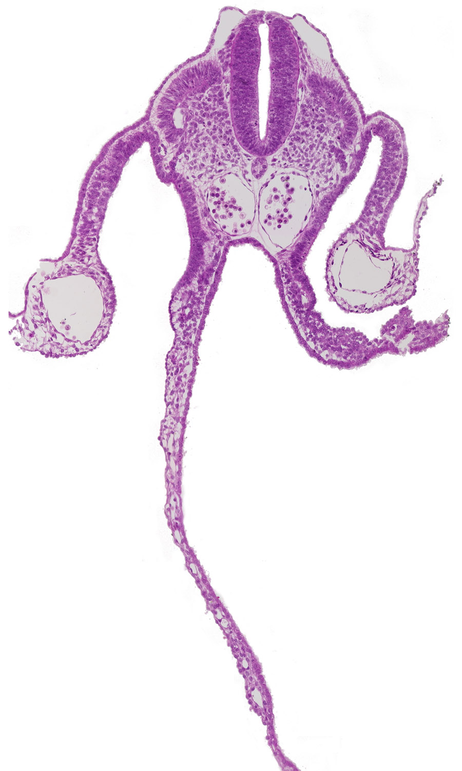 amnion attachment, amniotic cavity, dermatomyotome 10 (C-6), extra-embryonic coelom, midgut, neural tube, notochord, peritoneal cavity, right umbilical vein, sclerotome