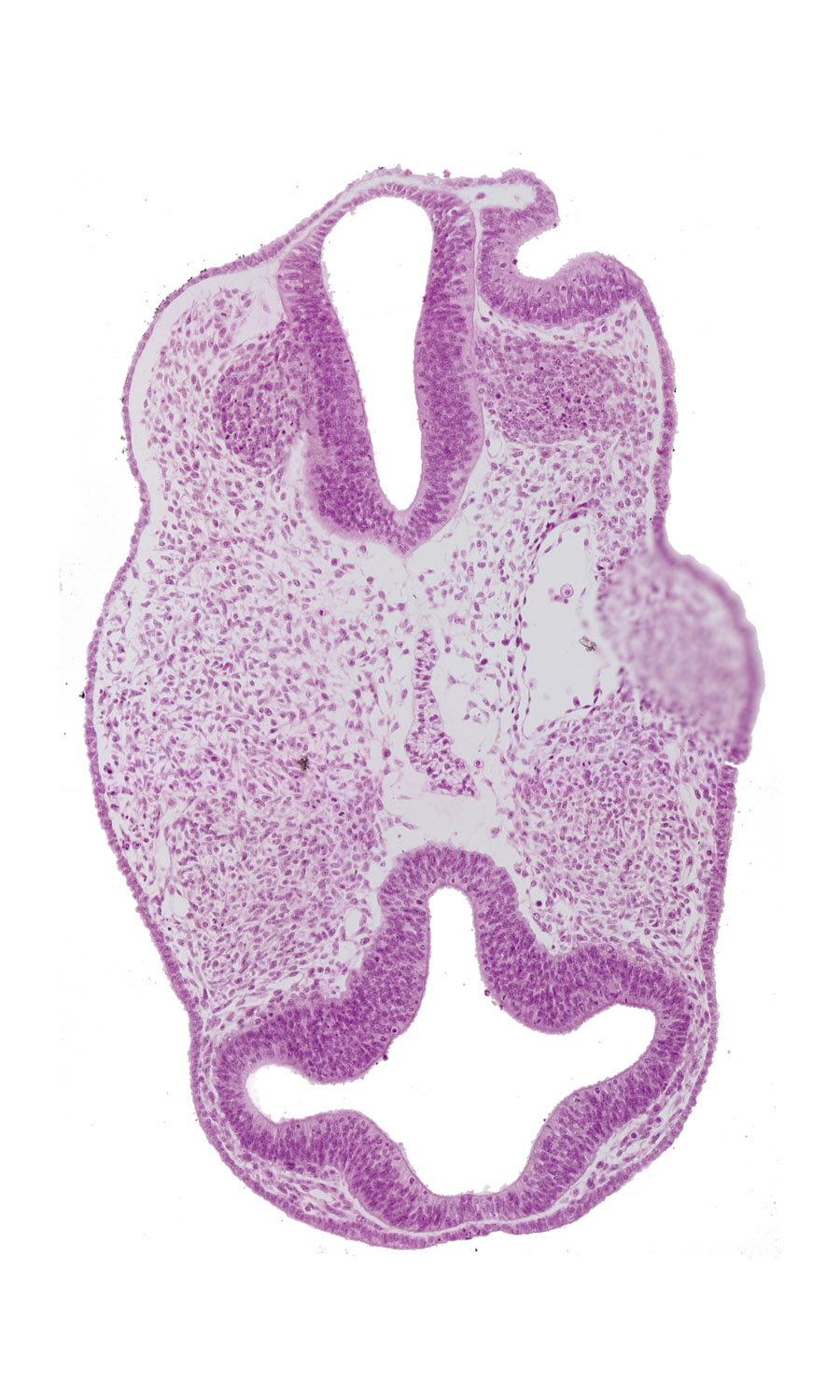 diencephalon (D1), diencephalon (D2), dorsal aorta, facio-vestibulocochlear neural crest (CN VII and CN VIII), intraretinal space (optic vesicle cavity), open otic vesicle, optic vesicle (D1), origin of internal carotid artery, otic pit, perinotochordal lamina, prosencoel (third ventricle), rhombencephalon (Rh. 4), surface ectoderm, venous plexus(es)