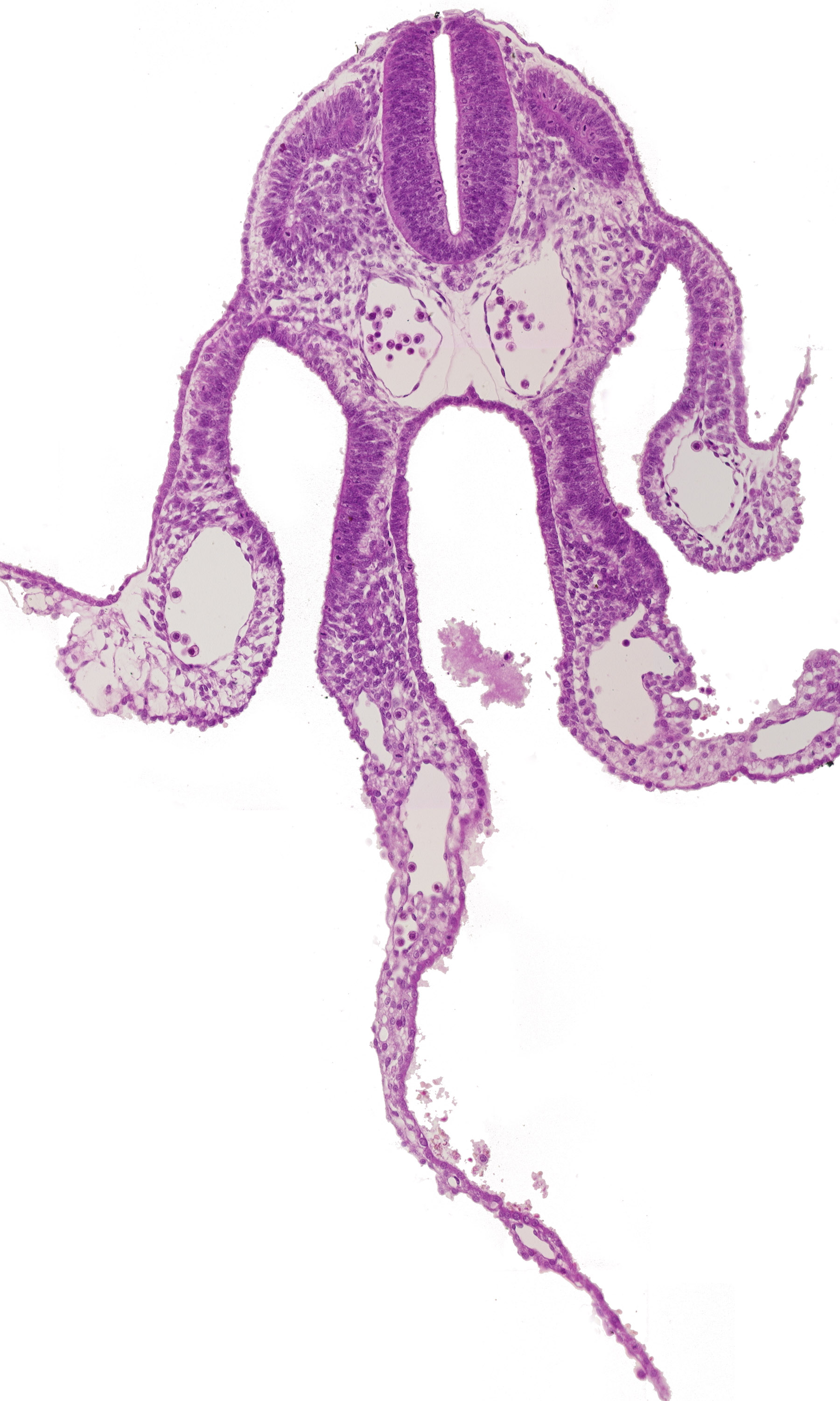 communication between peritoneal cavity and extra-embryonic coelom, dermatomyotome 7 (C-3), dorsal aorta, midgut, primary umbilical vesicle stalk, specialized coelomic wall, umbilical vesicle cavity