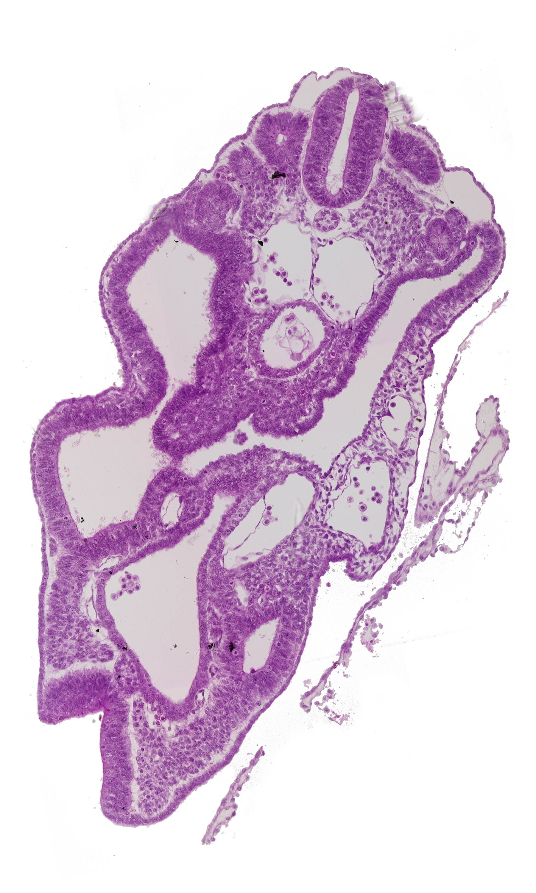 aortic bifurcation, caudal edge of dermatomyotome 14 (T-2), cloaca, hindgut, left umbilical artery, left umbilical vein, mesonephric duct, right umbilical artery