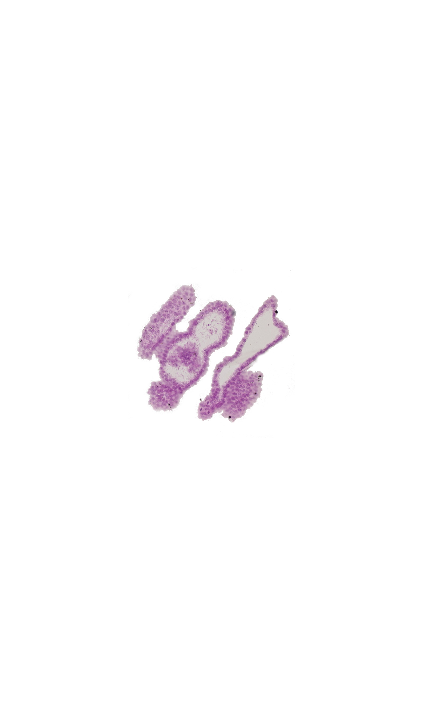 dorsal edge of somite 21 (T-9), longitudinal section of surface ectoderm, surface ectoderm