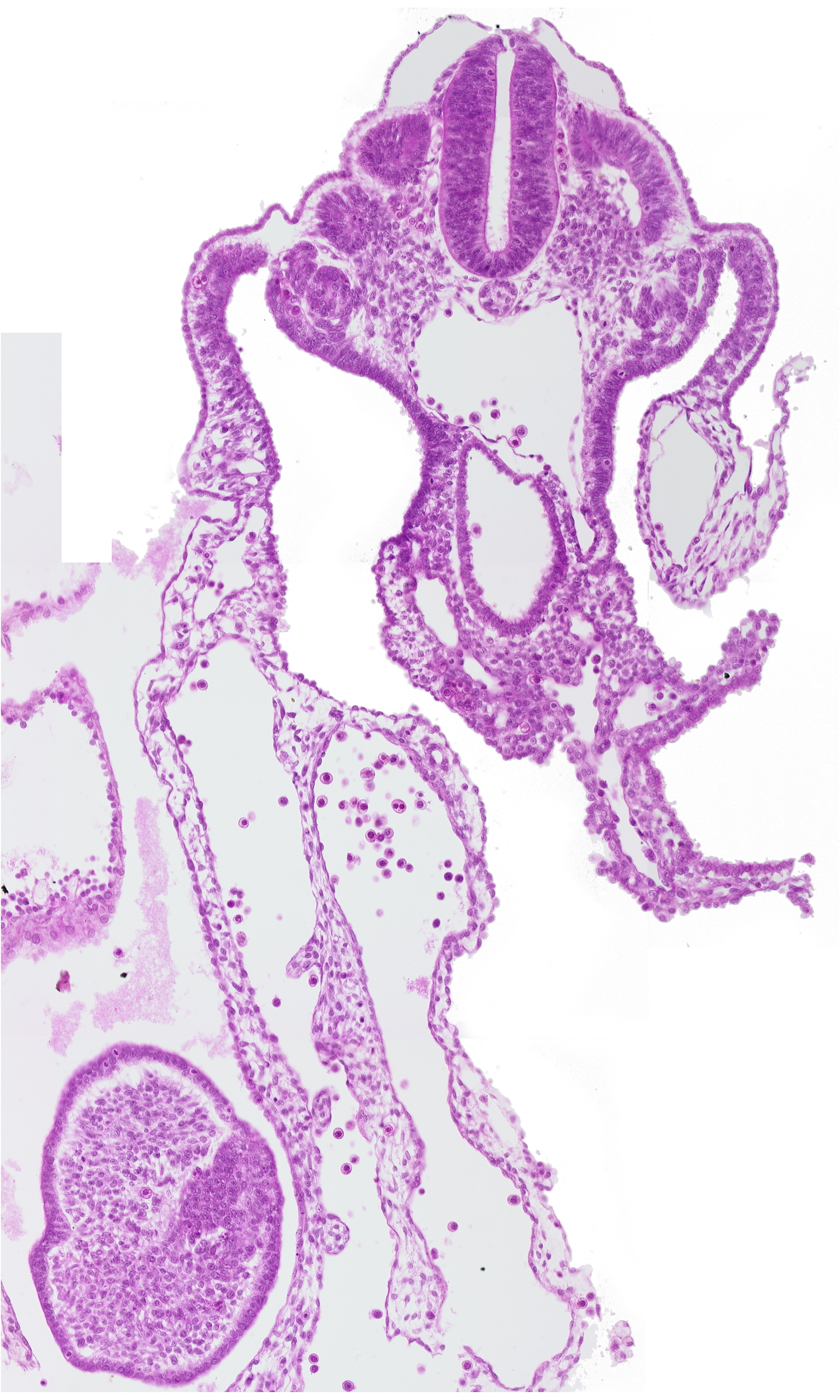 aorta, caudal edge of cloaca, caudal eminence, dermatomyotome 12 (C-8), hindgut, hindgut artery, somitocoel