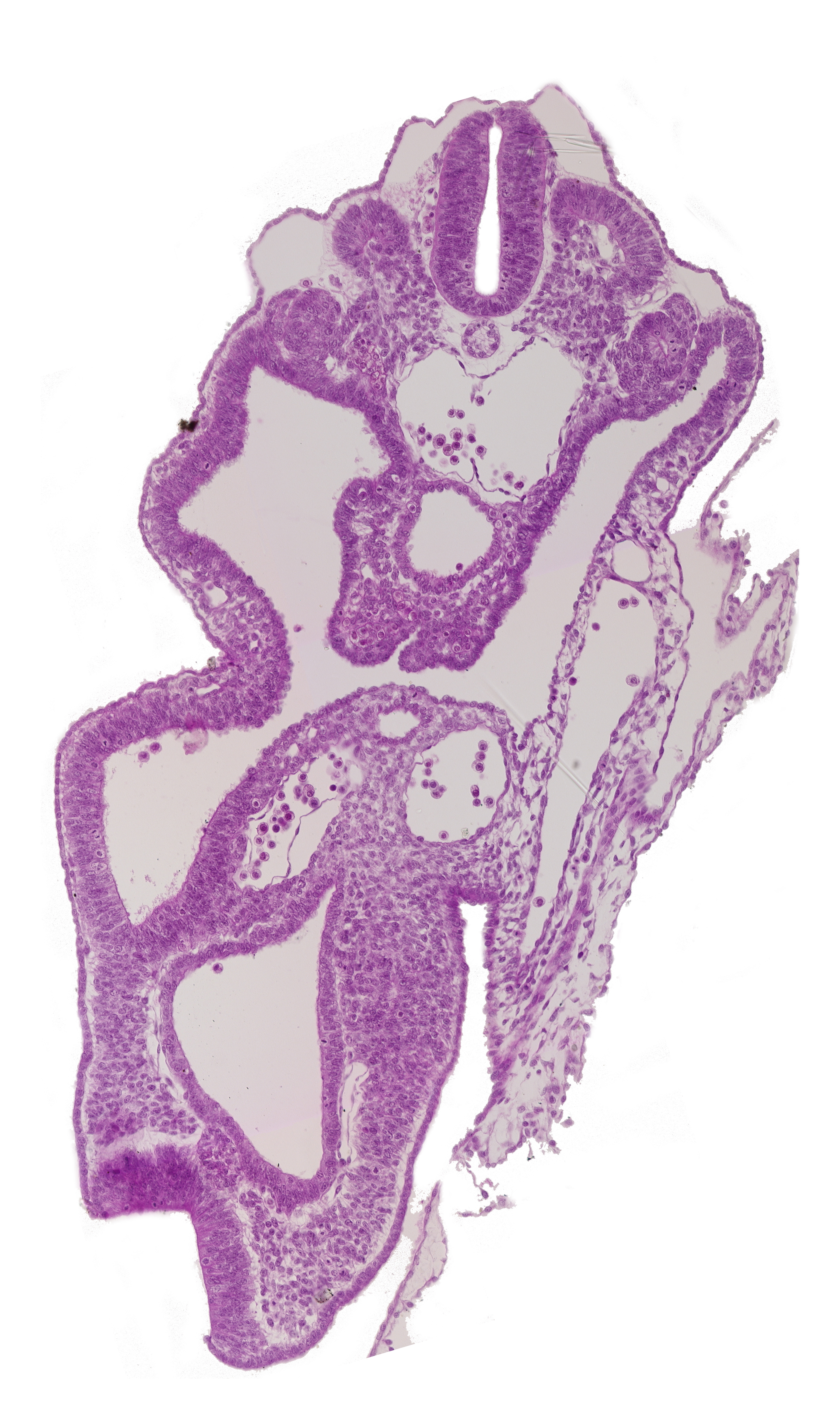 allantois, aorta, cloaca, dermatomyotome 14 (T-2), hindgut, left umbilical artery, notochord, peritoneal cavity, right umbilical artery