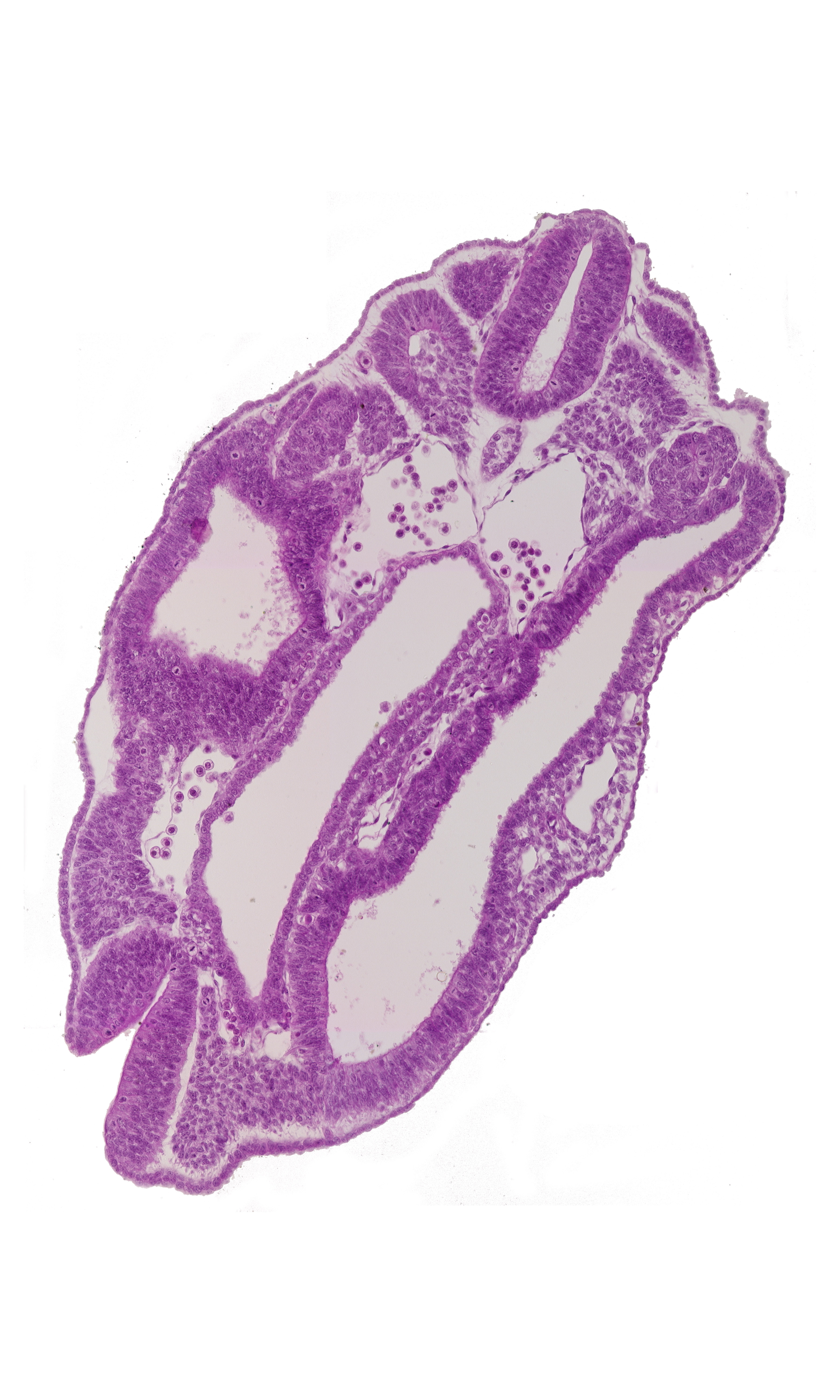 dermatomyotome 15 (T-3), left common iliac artery, notochord, peritoneal cavity, right common iliac artery, somatopleuric mesoderm