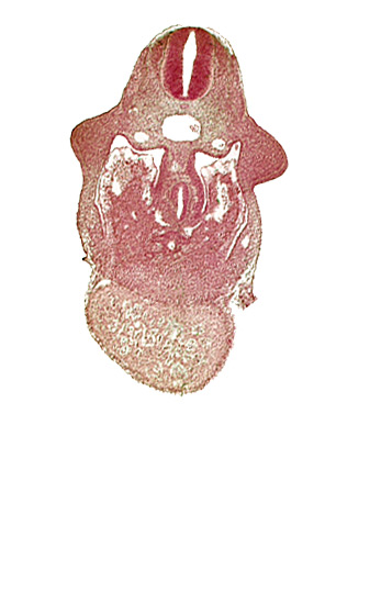 alar plate(s), basal plate, coelomic cavity, common aorta, common ventricle, dermatomyotome 9 (C-5), dorsal pancreatic bud, duodenum primordium, hepatic lamina(e), hepatic sinusoid, hepatocardiac vein, postcardinal vein, septum transversum, specialized coelomic wall, upper limb bud