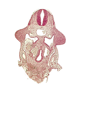 amnion attachment, aorta, apical ectodermal ridge, dermatomyotome 9 (C-5), dorsal pancreatic bud, duodenum primordium, hepatic antrum, marginal layer, neural tube, notochord, postcardinal vein, sulcus limitans, upper limb bud