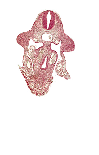 amnion attachment, aorta, apical ectodermal ridge, coelomic cavity, duodenum primordium, hepatic antrum, notochord, postcardinal vein, sulcus limitans, upper limb bud