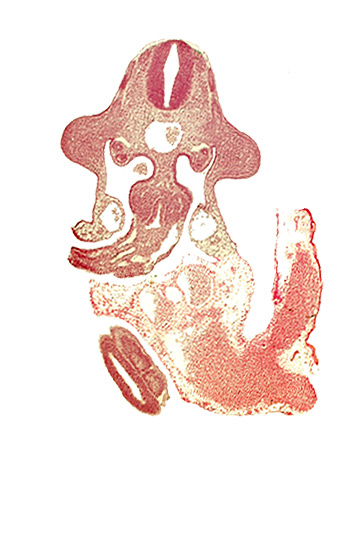 alar plate(s), aorta, basal plate, coelomic cavity, dermatomyotome 10 (C-6), dermatomyotome 11 (C-7), left vitelline (omphalomesenteric) vein, mesentery proper, mesonephric vesicle(s), somite 31 (S-2), somite 32 (S-3), sulcus limitans