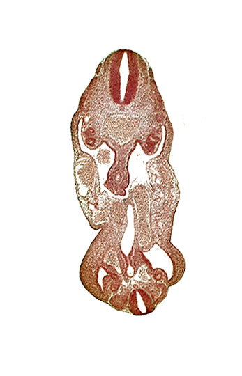 T-1 spinal ganglion primordium, aorta, coelom, dermatomyotome 14 (T-2), dermatomyotome 27 (L-3), gonadal epithelium, hindgut, left common iliac artery, left umbilical artery, lower limb bud, mesonephric ridge, neural canal, notochord, rectum primordium, urogenital sinus, urorectal septum