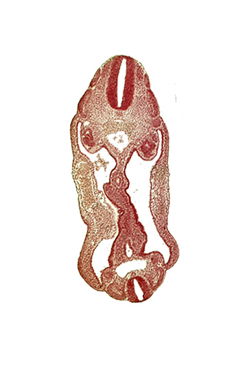 T-2 spinal ganglion primordium, aorta, aortic bifurcation, coelom, dermatomyotome 14 (T-2), dermatomyotome 15 (T-3), dermatomyotome 26 (L-2), hindgut, mesentery, mesonephric duct, neural tube, origin of primary intestinal plexus artery, sclerotome