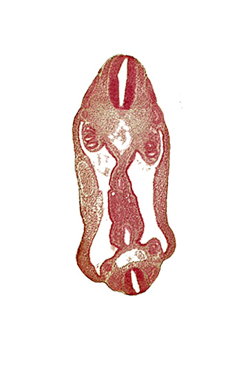 aorta, aortic bifurcation, coelom, dermatomyotome 15 (T-3), dermatomyotome 26 (L-2), hindgut, mesentery, neural tube, notochord