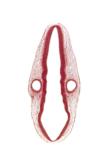 cranial edge of root of accessory nerve (CN XI), cranial edge of root of vagus nerve (CN X), mantle layer, marginal layer, middle dural venous plexus, otic vesicle, posterior dural venous plexus, rhombencephalon (hindbrain), rhombencoel (fourth ventricle), rhombomere 4, rhombomere 6, rhombomere 7, roof plate