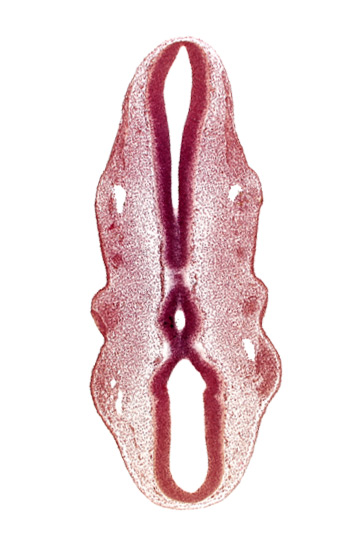 epipharyngeal placode 2, primary head vein, primordium of facial nerve (CN VII), rhombencoel (fourth ventricle), rhombomere 1, rhombomere 2, sulcus limitans, venous plexus(es)