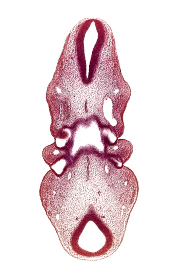 junction of aortic arch 3 and dorsal aorta, notochord, pharynx primordium