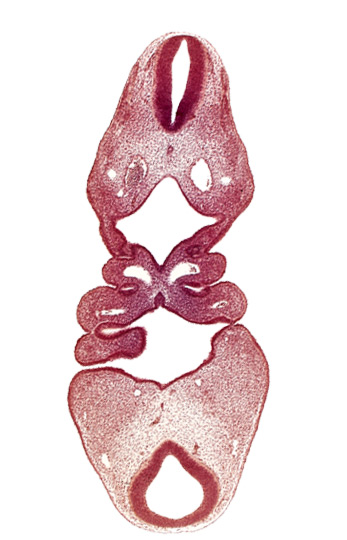 aortic arch 2, aortic arch 3, dermatomyotome 4 (O-4) , dermatomyotome 5 (C-1), dorsal aorta, internal carotid artery, junction of adenohypophysial pouch ectoderm and notochord, mesencoel (cerebral aqueduct), notochord, pharyngeal arch 1, pharyngeal arch 3, pharyngeal pouch 1, pharyngeal pouch 3, pharyngeal pouch 4, precardinal vein, primary head vein, sclerotome, tectum of mesencephalon, tegmentum of mesencephalon, thyroid diverticulum