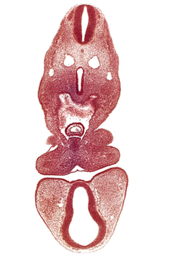 anterior dural vein, caudal edge of pharyngeal arch 2, cephalic edge of left atrium, dermatomyotome 5 (C-1), dorsal thalamus (diencephalon), mandibular prominence of pharyngeal arch 1, oral fissure, pericardial cavity, precardinal vein, prosencoel (third ventricle), separation artifact, truncus arteriosus, ventral thalamus (diencephalon)