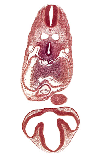 C-2 spinal ganglion primordium, dermatomyotome 6 (C-2), dorsal thalamus, epithalamus, left atrium, mandibular prominence of pharyngeal arch 1, mesocardium, notochord, optic vesicle, pericardial cavity, precardinal vein, prosencoel (third ventricle), right atrium, tracheo-esophageal tube, ventral thalamus