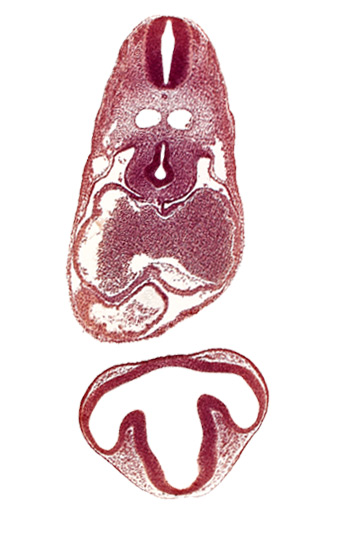 bulbis cordis, dermatomyotome 6 (C-2), diencephalon, dorsal aorta, esophagus primordium, intraretinal space (optic vesicle cavity), junction of postcardinal and precardinal veins, lens disc, mesocardium, nucleated red blood cells in left atrium, ostium primum, pericardial cavity, precardinal vein, primary interatrial septum (septum primum), right atrium, trachea primordium