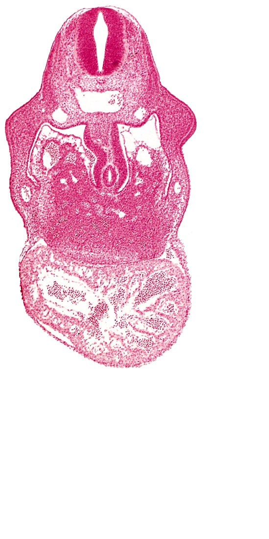 anterior interventricular sulcus, cephalic edge of septum tranversum, coelomic cavity, dermatomyotome 8 (C-4), dorsal mesogastrium, endocardium, hepatic lamina(e), hepatic sinusoid, hepatocardiac vein, notochord, postcardinal vein, primary interventricular foramen, right umbilical vein, stomach primordium, united dorsal aortas, upper limb bud, ventral mesogastrium