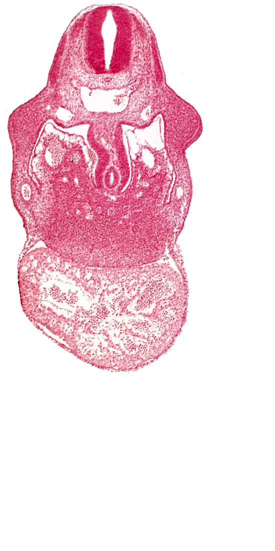 alar plate(s), basal plate, caudal edge of C-4 spinal ganglion primordium, dermatomyotome 8 (C-4), hepatic sinusoid, intersegmental artery, junction of duodenum and stomach primordia, left ventricle, pericardial cavity, postcardinal vein, right umbilical vein, right ventricle: endocardium, right ventricle: epimyocardium, septum transversum, specialized coelomic wall, upper limb bud, ventral mesogastrium