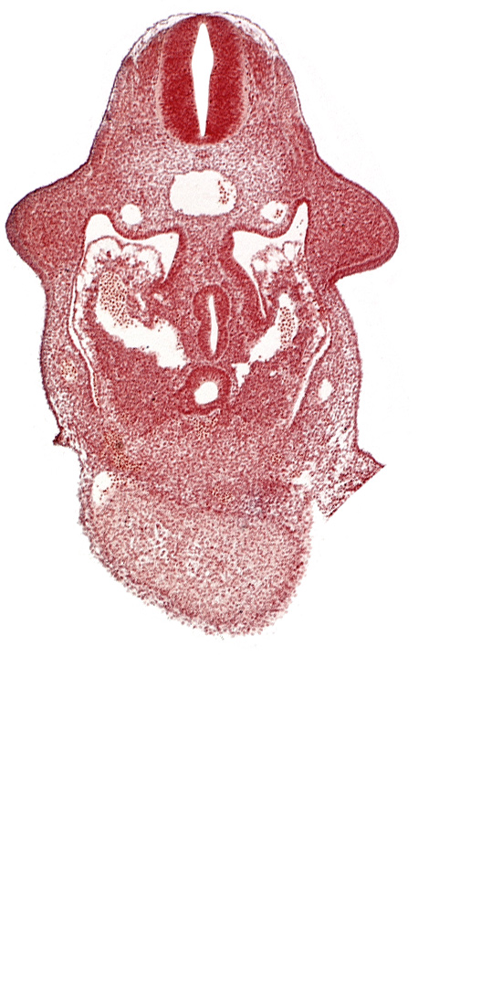 C-5 spinal ganglion primordium, amnion attachment, aorta, caudal edge of common ventricle, dermatomyotome 9 (C-5), dorsal pancreatic bud, duodenum primordium, hepatic antrum, left hepatocardiac vein, left umbilical vein, notochord, pericardial cavity, right hepatocardiac vein, septum transversum, specialized coelomic wall, upper limb bud