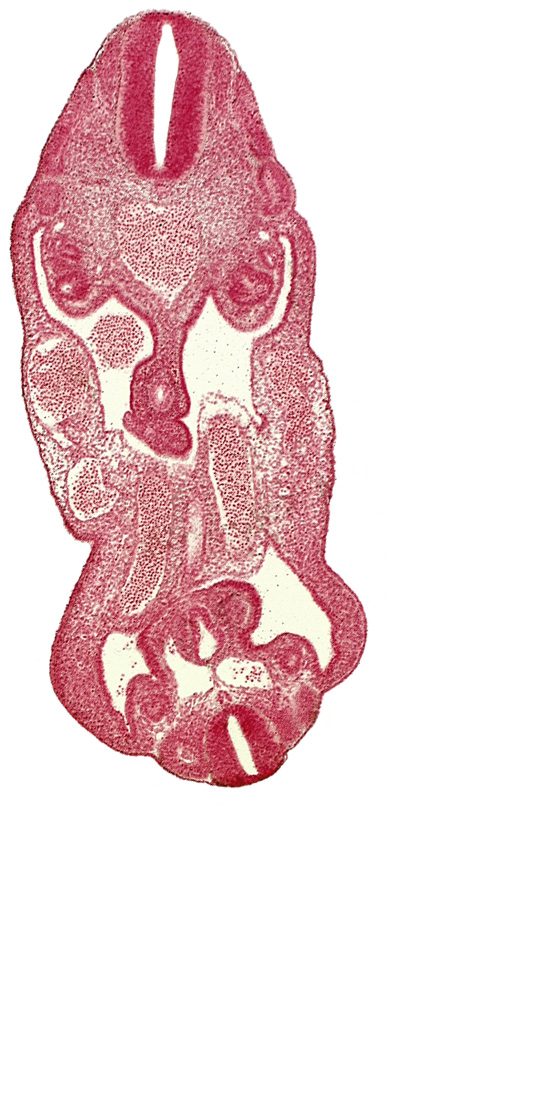 aorta, coelom, dermatomyotome 14 (T-2), dermatomyotome 26 (L-2), hindgut, left common iliac artery, left umbilical artery, mesonephric duct, neural canal, notochord, right common iliac artery, right umbilical vein