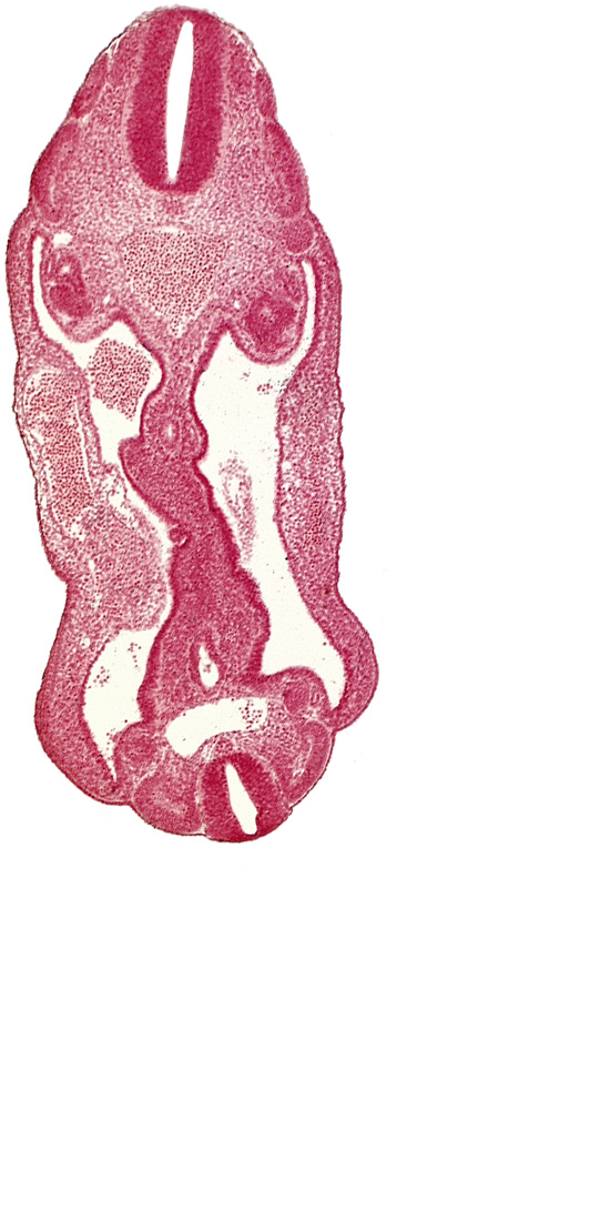 T-2 spinal ganglion primordium, aorta, aortic bifurcation, coelom, dermatomyotome 14 (T-2), dermatomyotome 15 (T-3), dermatomyotome 26 (L-2), hindgut, mesentery, mesonephric duct, neural tube, origin of primary intestinal plexus artery, sclerotome