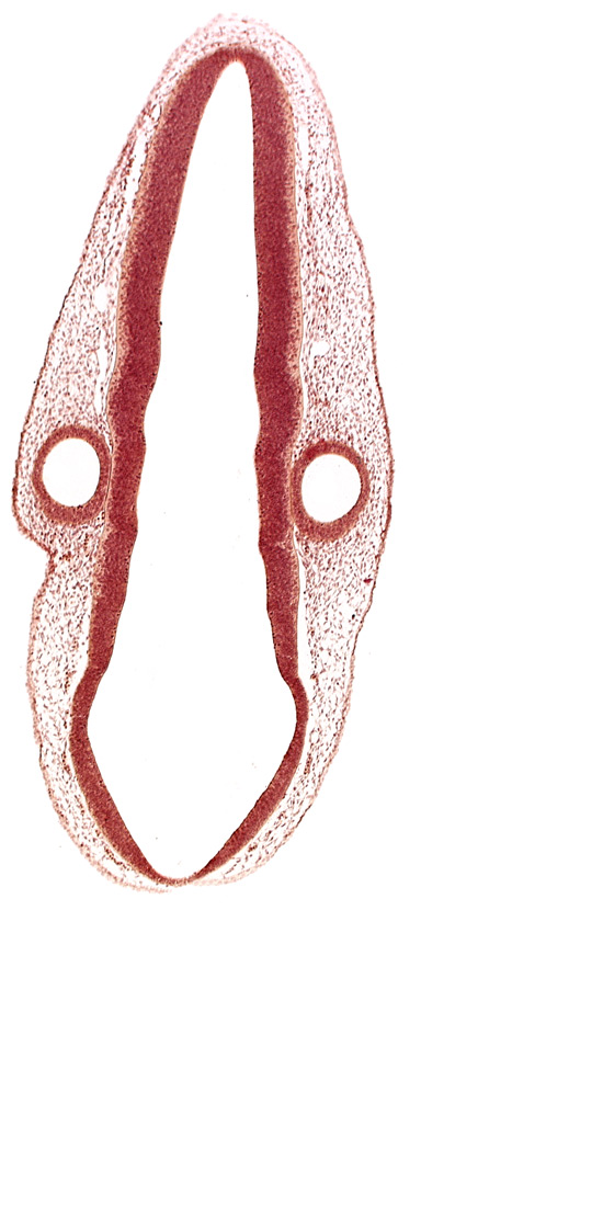 head mesenchyme, mantle layer, otic vesicle, posterior dural venous plexus, rhombencoel (fourth ventricle), roof plate, surface ectoderm