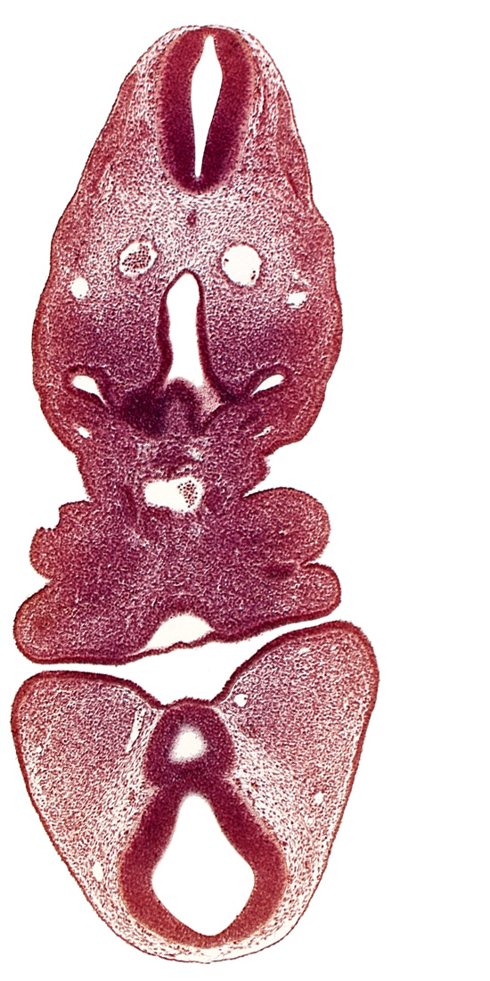 caudal edge of pharyngeal pouch 1, cervical sinus, dermatomyotome 5 (C-1), dorsal aorta, junction of aortic sac and truncus arteriosus, junction of diencephalon and mesencephalon, mamillary recess, mesencephalon, precardinal vein