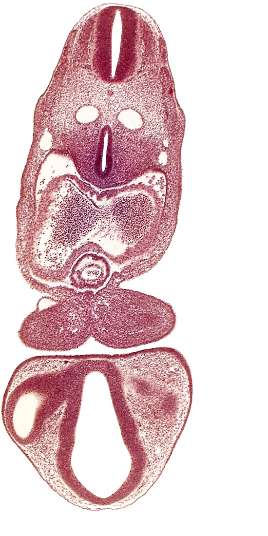 caudal edge of left optic vesicle, chiasmatic part of diencephalon, dermatomyotome 5 (C-1), dermatomyotome 6 (C-2), dorsal aorta, endocardium, epicardial ridge, intraretinal space (optic vesicle cavity), left atrium, mandibular prominence of pharyngeal arch 1, marginal layer of spinal cord, median mandibular groove, notochord, optic stalk (CN II), pericardial cavity, precardinal vein, prosencoel (third ventricle), right atrium, separation artifact, tracheo-esophageal tube, truncus arteriosus, ventral thalamus