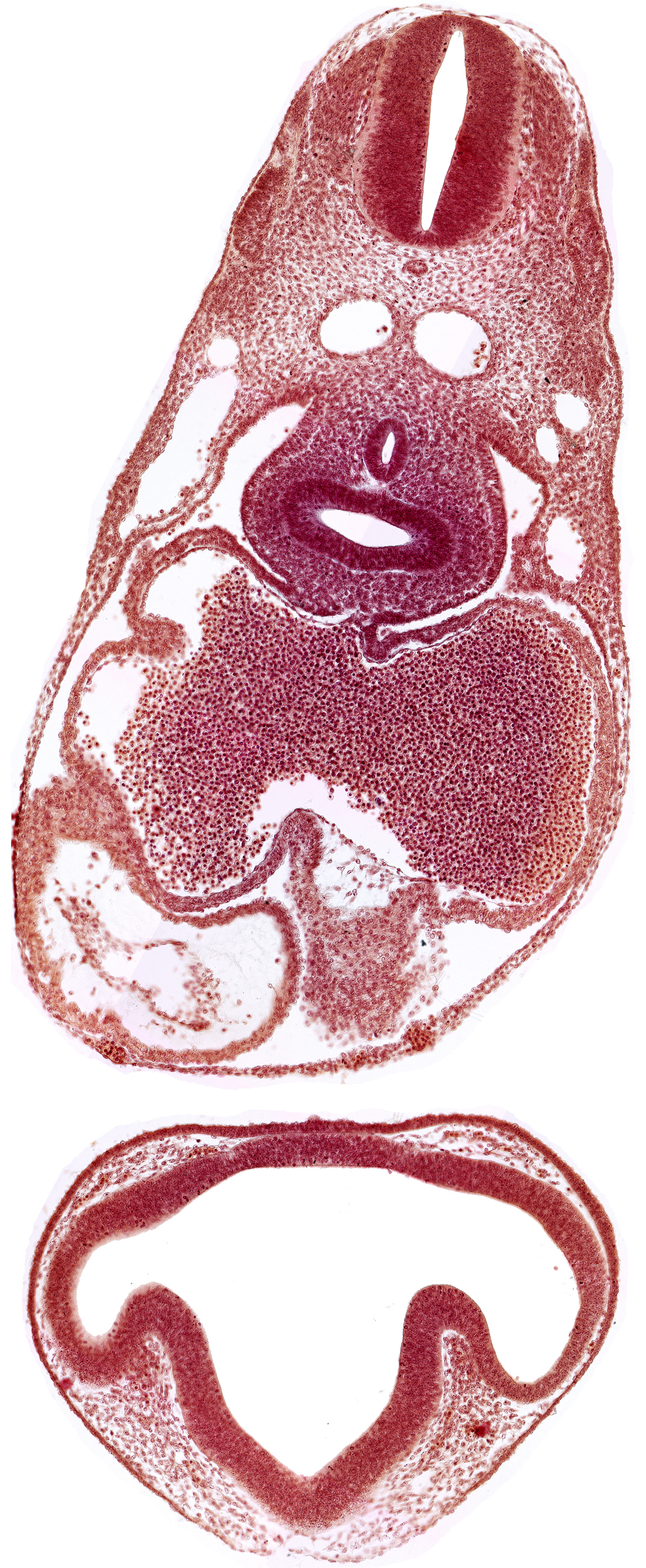 common cardinal vein, conus cordis: endocardium, conus cordis: epimyocardium, conus cordis: gelatinous reticulum, dermatomyotome 6 (C-2), dermatomyotome 7 (C-3), intraretinal space (optic vesicle cavity), left aorta, left atrium, left lung bud, lens disc, mesocardium, notochord, optic evagination, optic part of retina, pericardial cavity, pericardioperitoneal canal (pleural cavity), postcardinal vein, prosencoel (third ventricle), right atrium, right lung bud, sclerotome, sinu-atrial foramen, sinus venosus, trachea primordium, ventral thalamus (diencephalon)