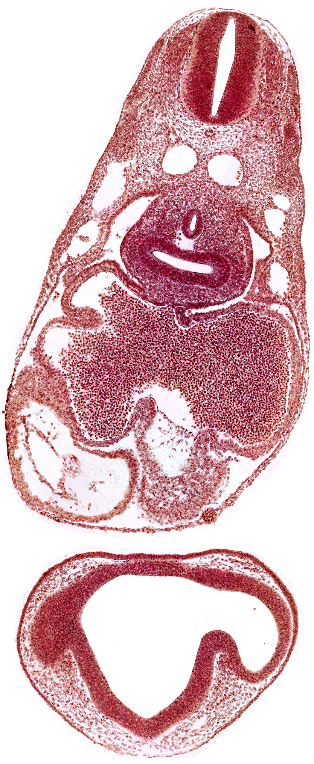 caudal edge of optic vesicle, common atrioventricular canal, common cardinal vein, dermatomyotome 6 (C-2), dermatomyotome 7 (C-3), esophagus primordium, left atrium, notochord, optic part of retina, pericardial cavity, pericardioperitoneal canal (pleural cavity), postcardinal vein, primary interatrial septum (septum primum), prosencoel (third ventricle), right atrium, right lung bud, sinus venosus, ventral thalamus (diencephalon)