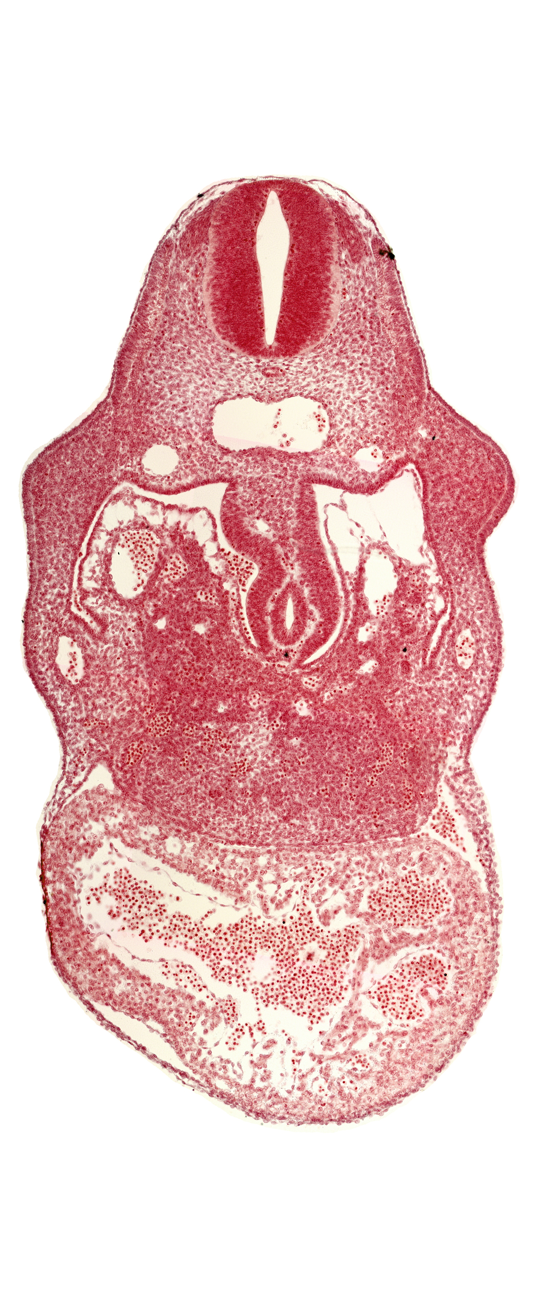 C-4 spinal ganglion primordium, anterior interventricular sulcus, coelomic cavity, dorsal mesogastrium, endocardium, hepatic sinusoid, hepatocardiac vein, left umbilical vein, notochord, postcardinal vein, primary interventricular foramen, right umbilical vein (involuting), stomach primordium, united dorsal aortas, upper limb bud, ventral mesogastrium