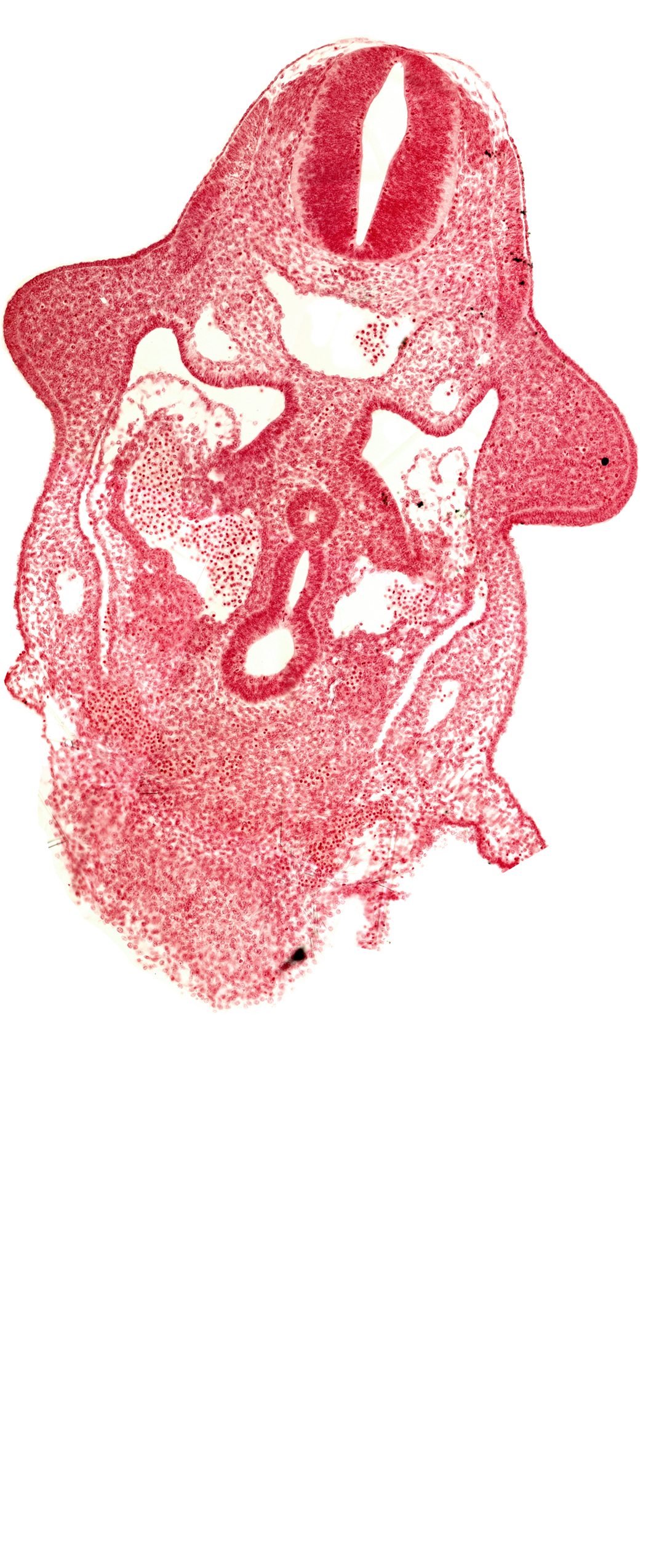 amnion attachment, aorta, caudal edge of common ventricle, dermatomyotome 9 (C-5), dorsal intersegmental artery, dorsal pancreatic bud, hepatic antrum, left hepatocardiac vein, notochord, postcardinal vein, right hepatocardiac vein, specialized coelomic wall, upper limb bud