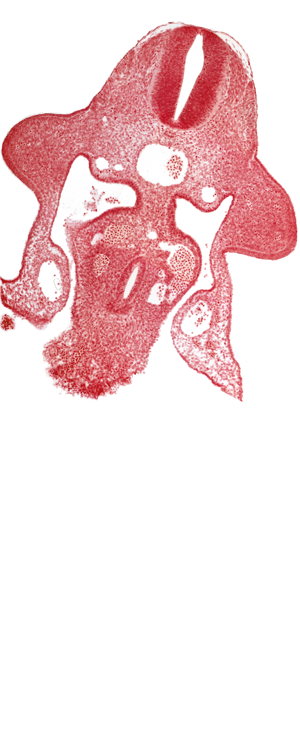 amnion attachment, aorta, coelomic cavity, communication of coelomic cavity with extra-embryonic coelom, duodenum primordium, junction of hepatocardiac and left vitelline veins, marginal layer, notochord, postcardinal vein, sulcus limitans, upper limb bud, vitelline (omphalomesenteric) vein