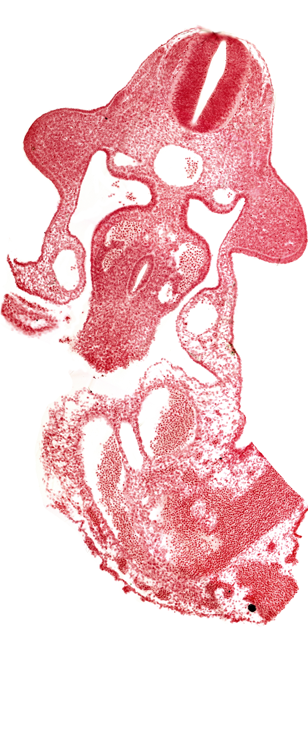 allantois, aorta, coelomic cavity, dorsal mesentery, left umbilical artery, left umbilical vein, left vitelline (omphalomesenteric) vein, neural tube, postcardinal vein, right umbilical artery, right umbilical vein, umbilical cord, upper limb bud