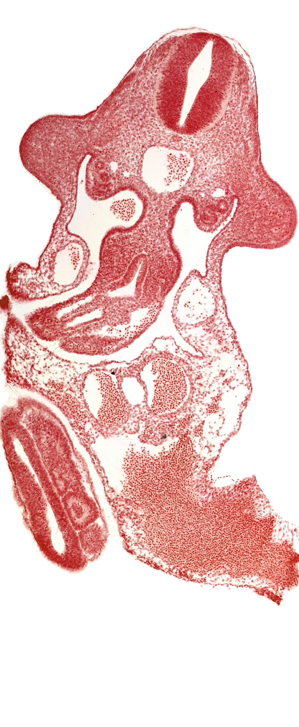 alar plate(s), aorta, basal plate, left umbilical artery, left umbilical vein, marginal layer, mesentery proper, mesonephric duct, midgut, neural canal, neural tube, omphaloenteric duct, paraxial mesoderm, right umbilical artery, right vitelline (omphalomesenteric) vein, somite 30 (S-1), somite 31 (S-2), somite 32 (S-3), upper limb bud