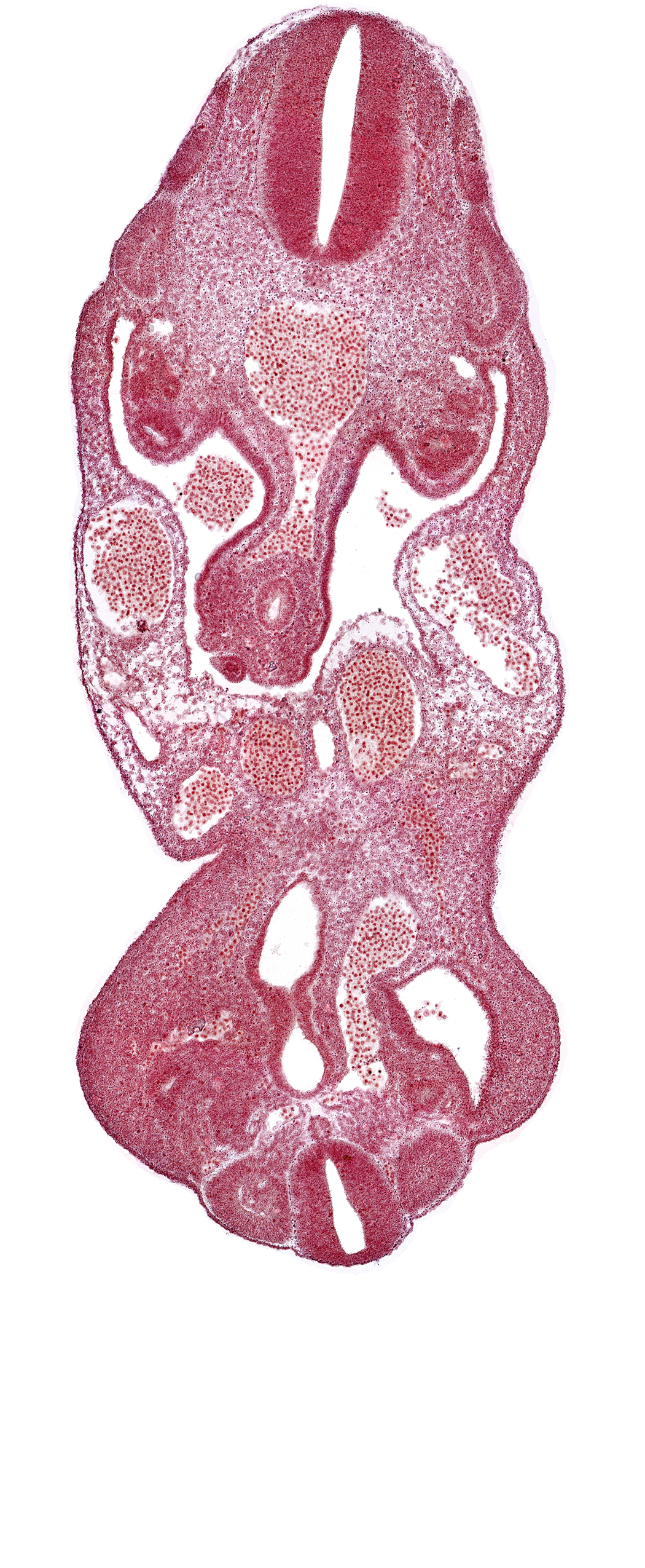 allantois, coelom, dermatomyotome 13 (T-1), dermatomyotome 27 (L-3), left umbilical artery, left umbilical vein, lower limb bud, notochord, rectum primordium, right umbilical artery, right umbilical vein, urogenital sinus, urorectal septum