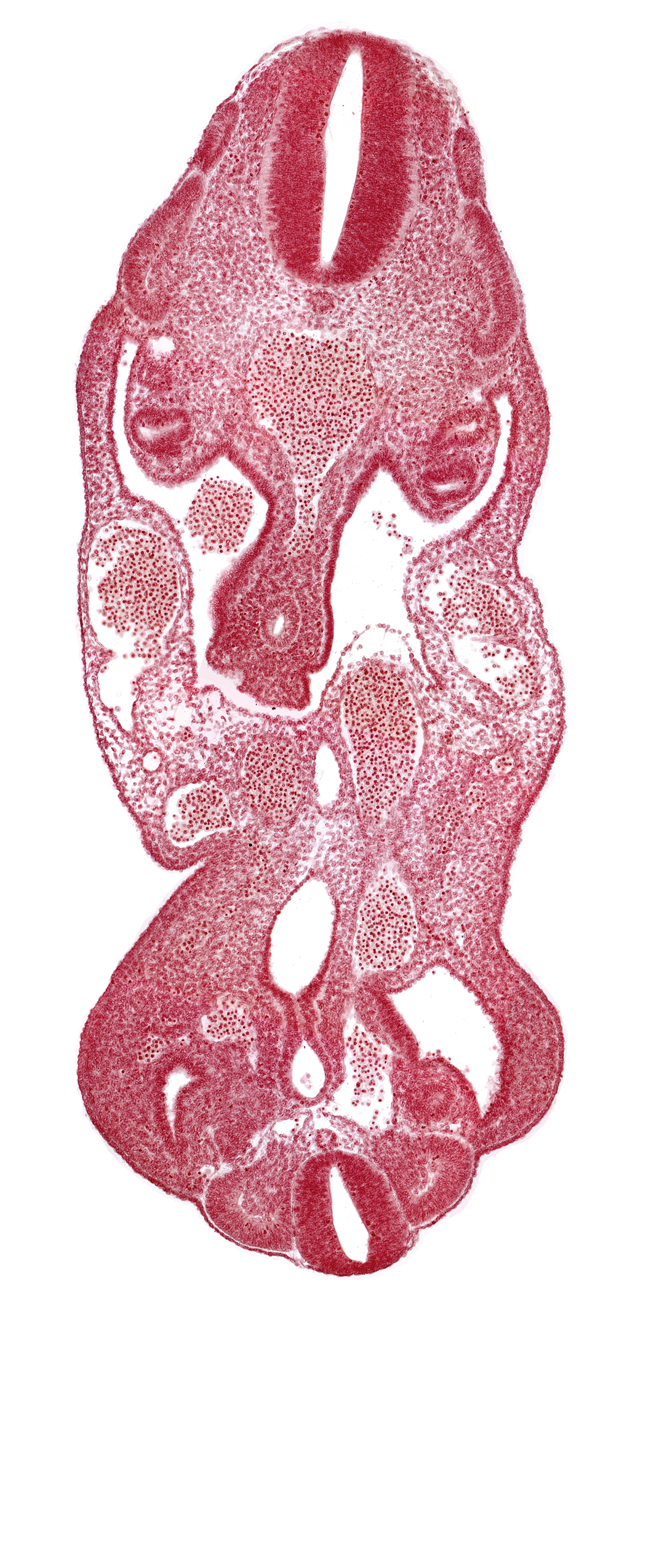 T-1 spinal ganglion primordium, allantois, aorta, coelom, dermatomyotome 13 (T-1), dermatomyotome 14 (T-2), dermatomyotome 27 (L-3), gonadal epithelium, hindgut, left common iliac artery, left umbilical artery, lower limb bud, mesonephric ridge, neural canal, notochord, origin of primary intestinal plexus artery, rectum primordium, sclerotome, urogenital sinus, urorectal septum