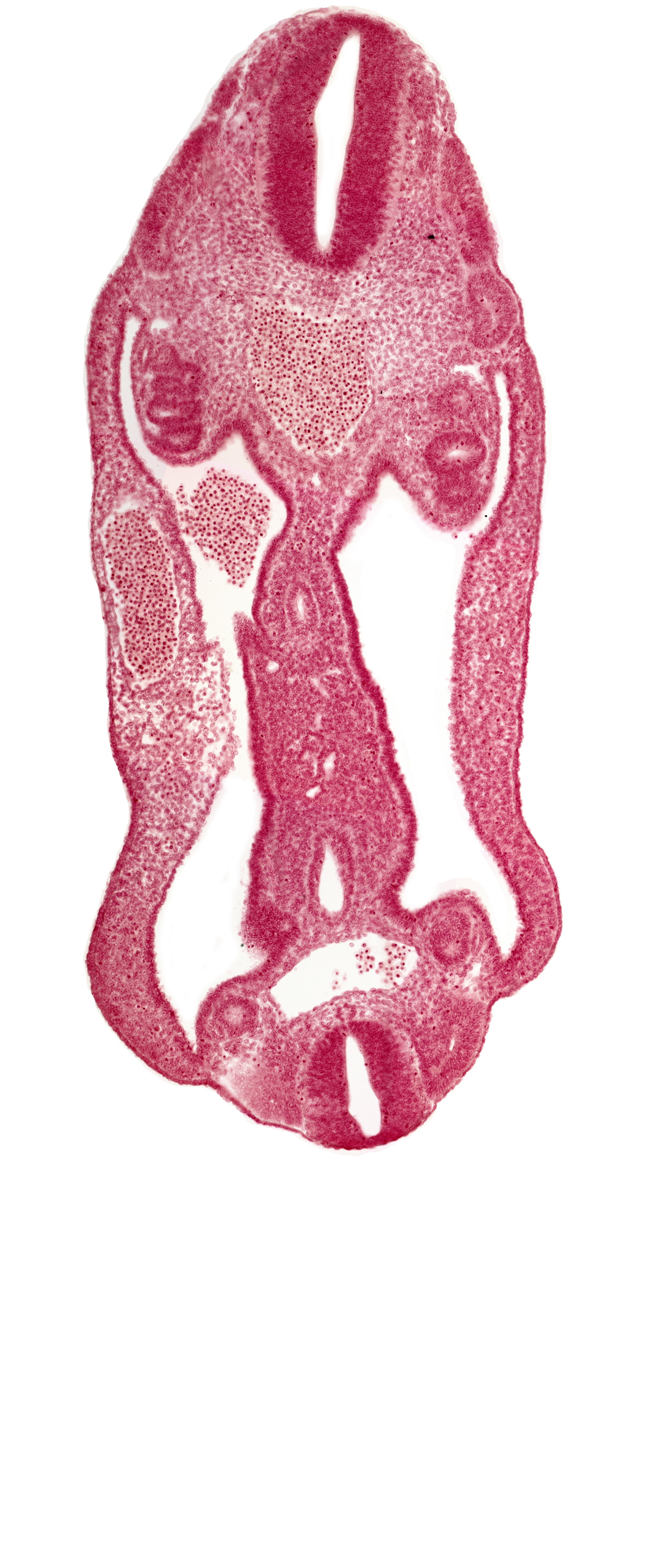 aorta, aortic bifurcation, coelom, dermatomyotome 15 (T-3), dermatomyotome 26 (L-2), hindgut, mesentery, neural tube, notochord