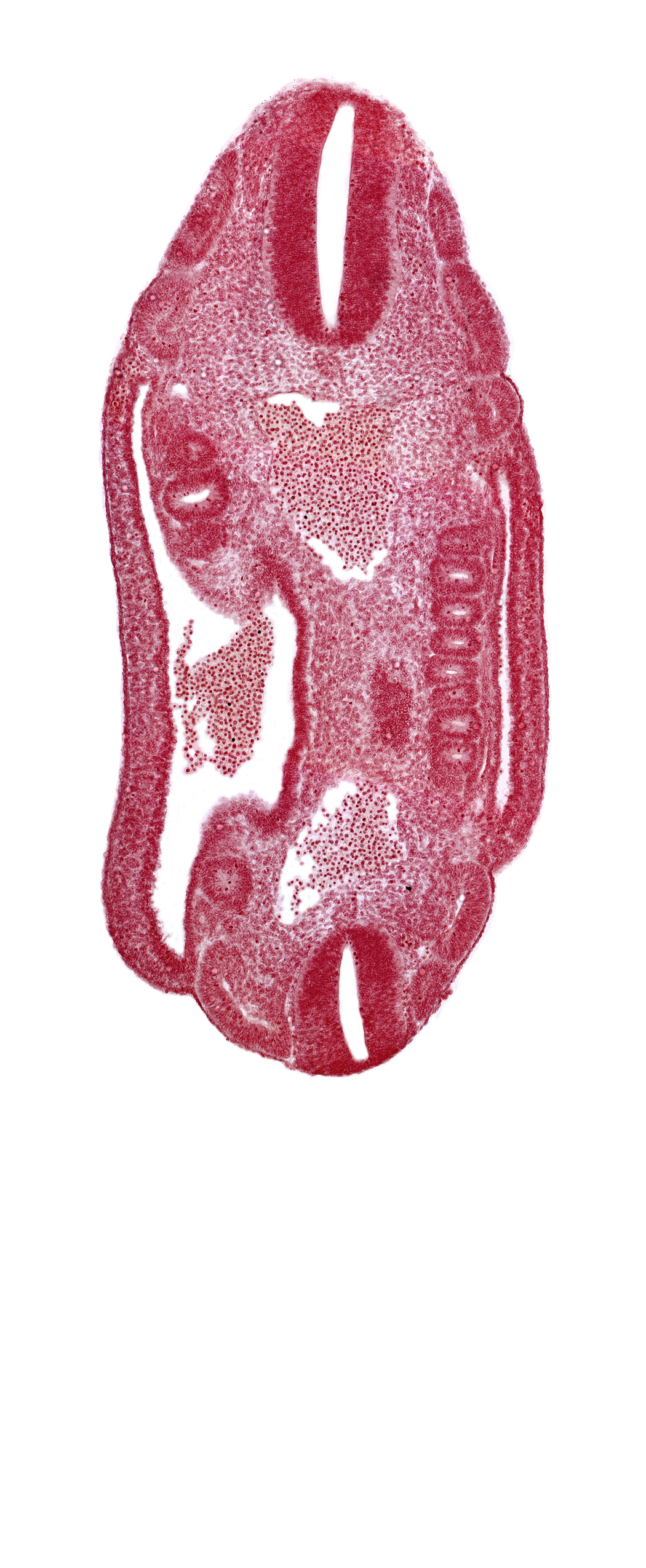 aorta, dermatomyotome 16 (T-4), dermatomyotome 17 (T-5), dermatomyotome 18 (T-6), dermatomyotome 24 (T-12), dermatomyotome 25 (L-1), lateral body wall, mesonephric duct, mesonephric ridge, mesonephric vesicle(s), neural tube, roof plate of neural tube