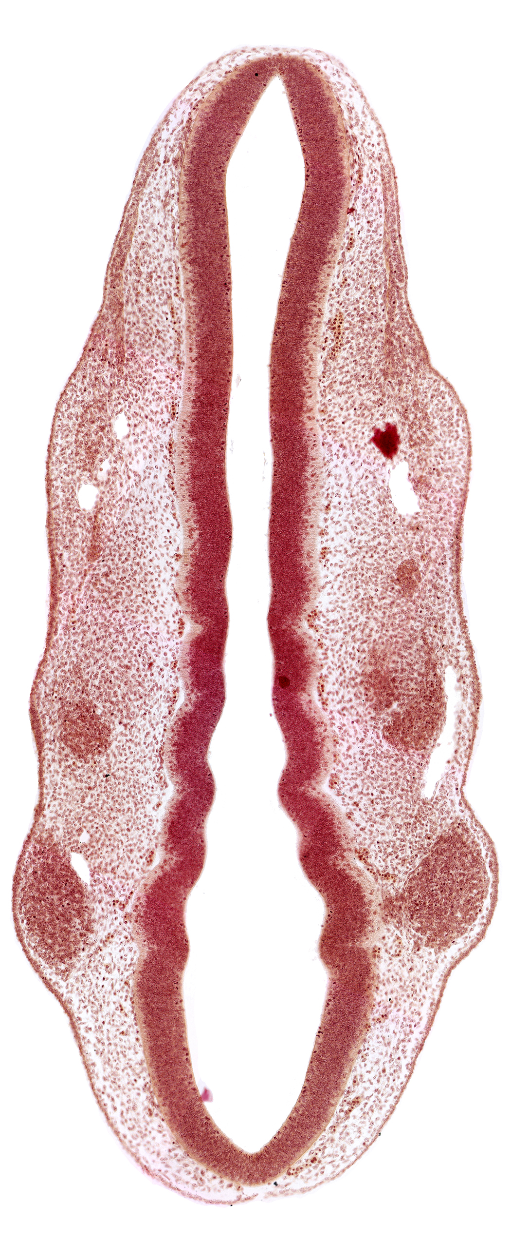 dermatomyotome 1 (O-1), dermatomyotome 2 (O-2) , pharyngeal arch 1, pharyngeal groove 1, primary head vein, primordium of facial and vestibulocochlear nerves (CN VII and CN VIII), primordium of trigeminal nerve (CN V), rhombomere 2, rhombomere 3, rhombomere 4, rhombomere 5, rhombomere 6