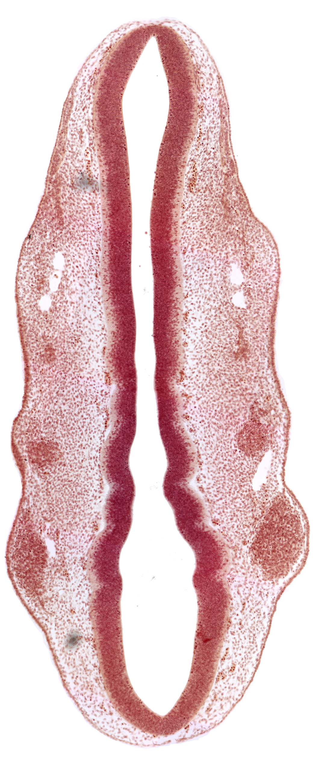 dermatomyotome 2 (O-2) , primary head vein, primordium of facial nerve (CN VII), primordium of glossopharyngeal nerve (CN IX), primordium of trigeminal nerve (CN V), rhombomere 2, rhombomere 3, rhombomere 4, rhombomere 5, rhombomere 6