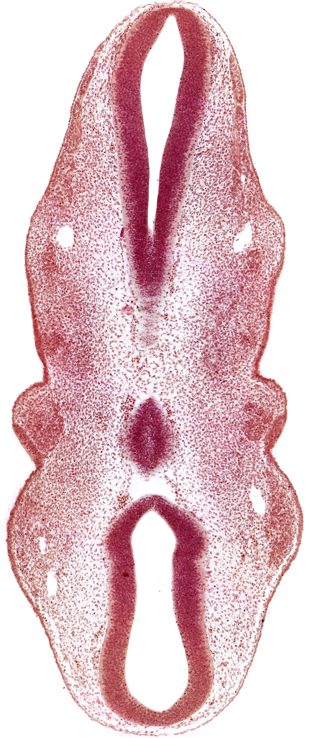 caudal part of rhombencephalon, cephalic part of rhombencephalon, precardinal vein, primary head vein, rhombencoel (fourth ventricle)